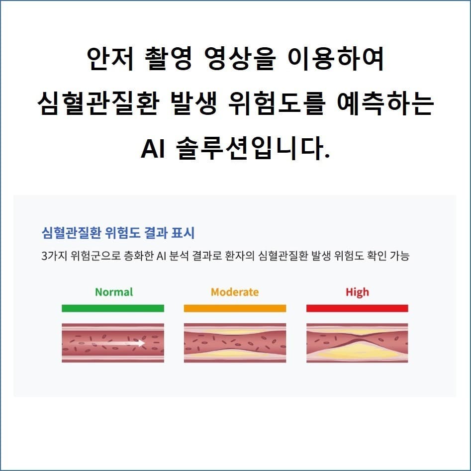안과질환 진단 및 심혈관질환 발생 위험도 예측 AI 솔루션